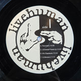 LIVE HUMAN MONOSTEROSIS THE NEW VICTROLA METHOD